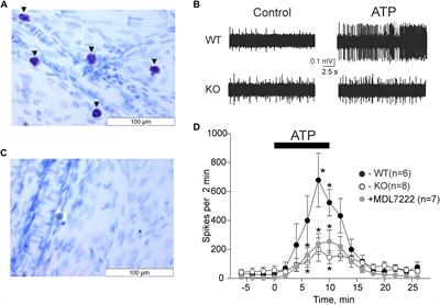 Meningeal Mast Cells Contribute to ATP-Induced Nociceptive Firing in Trigeminal Nerve Terminals: Direct and Indirect Purinergic Mechanisms Triggering Migraine Pain